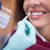 Things to Know Before Choosing Teeth Whitening in Summit