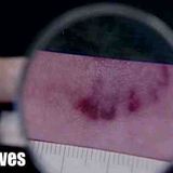 Bites That Solved Three Shocking Murders _ The New Detectives