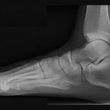 Feet of Engineering with Michael DiTullo and Jason Hanft