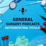 Understanding Gastrointestinal Fistulae: Causes, Symptoms, Treatment, & Care 🏥