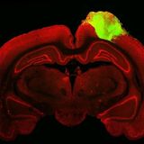 Human Brain Organoids Respond to Visual Stimuli When Transplanted Into Adult Rats [W[R]C]
