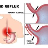 Survival Medicine Hour: Allergies, Acid Reflux, Respiratory Viruses