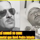 ⭐Cómo lucía PEDRO INFANTE tras PLACA de METAL en rostro⭐