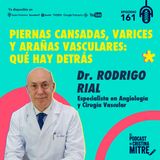Piernas cansadas, varices y arañas vasculares: qué hay detrás, con el Dr. Rodrigo Rial. Episodio 161.