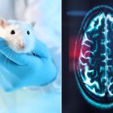 Ethic concerns Stanford researchers spark concern after transplanting human brain tissue to mice