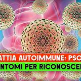 Malattia Autoimmune, Psoriasi: 5 Sintomi Per Riconoscerla!