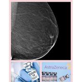 COVID-19 Vaccine Effects on Mammograms & The New AstraZeneca Vaccine