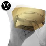 ¿Qué lleva un kit de alarma para el hogar? #458