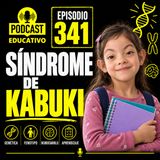 341-Síndrome de Kabuki