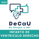 Episodio 65. Infarto de Ventrículo Derecho #Urgencias #Cardio