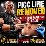 PICC Line Removed After Bone Infection (E. coli): 6 Months Oral Antibiotics, Rehab & Mindset