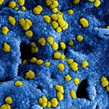 #LaCafeteraCordonSanitario .- La experta en Coronavirus Sonia Zúñiga contesta las dudas de los oyentes.
