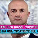 Gianluigi Nuzzi, Curiosità: Ecco Perchè Ha Una Cicatrice Sul Volto!