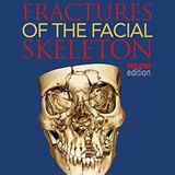 Fractures of the Facial Skeleton