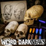 The Paracas Conehead Skulls and a DNA Test That Found No Answer | #WeirdDarkNEWS