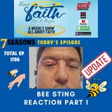 S7 Ep1708: Bee stings part 1