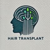 What is Hair Transplant? Best Hair Transplant Options