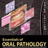 Essentials of Oral Pathology