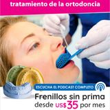 Importancia de los modelos de estudio en el tratamiento de ortodoncia