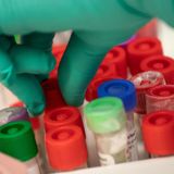 COVID-19 pandemic: What can we learn from Germany? | 9 April 2020