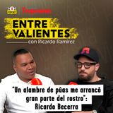 "Tuvieron que reconstruirme el rostro", el accidente que casi le cuesta la vida a Ricardo Becerra