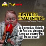 La  historia de Santiago Monarca, joven que padece 'Piel De Mariposa'