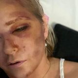 Virginia Giuffre Suicide | Another Epstein Victim Dead