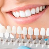 Bright Smiles on a Budget: Affordable Cosmetic Dentistry Options