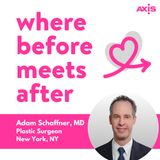 How soon can I get a revision after breast augmentation? [Adam Schaffner, MD, New York City]