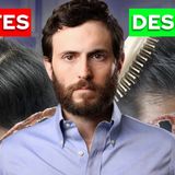 Por qué Perdemos Pelo y Cómo Frenarlo