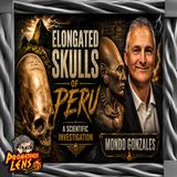 Elongated Skulls w/ Mondo Gonzales