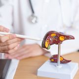 Es Salud de Verano: Cuida el hígado y cuidarás tu salud