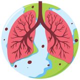 Tuberculose