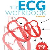 The ECG Workbook