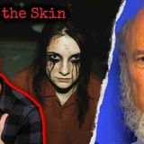 Top 3 Most Disturbing Ways To Get Yourself Sick