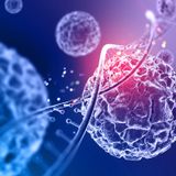 Carboidrati e rischio di cancro