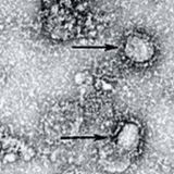 El coronavirus superó este lunes los 3 mil muertos en el mundo