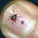 Ticks, What to Do?, Black Lung Help, Helping EMS and a White Picket Farm!