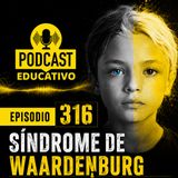 316- Síndrome de Waardenburg