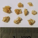 Dietary Strategies for Preventing Kidney Stones