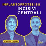 Implantoprotesi su INCISIVI CENTRALI: criticità e SEGRETI