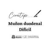 EP 10 - Muñón Duodenal Difícil