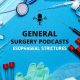 Esophageal Strictures Explained: Symptoms, Causes, and Treatment Options 🫁💡