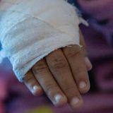 Bogotá y el drama de los quemados con pólvora: Cuatro menores de cinco años afectados en la noche de velitas