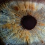 Lenti a contatto contro la depressione i ricercatori coreani usano la retina per stimolare il cervello