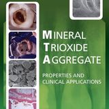 Mineral Trioxide Aggregate: Properties and Clinical Applications