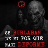SE BURLABAN DE MI POR QUE NACI DEFORME | RELATOS DE BRUJERIA | RELATOS Y LEYENDAS DE TERROR
