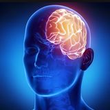 S55E19: Underneath The Thalamus Putting Pressure On The Amygdala They Found A Growing Tumour