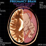 How to improve memory while pregnant