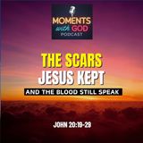 The Scars Jesus Kept - And His Blood That Still Speaks